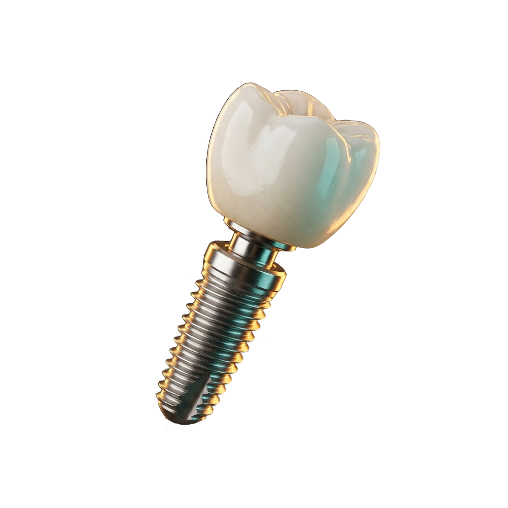 Advanced dental implant — modern restorative dentistry at Snow Tree Dental in Houston