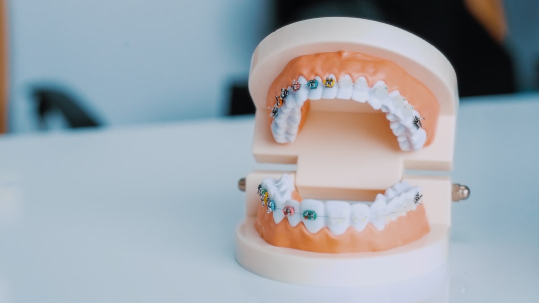 dental implants 77057