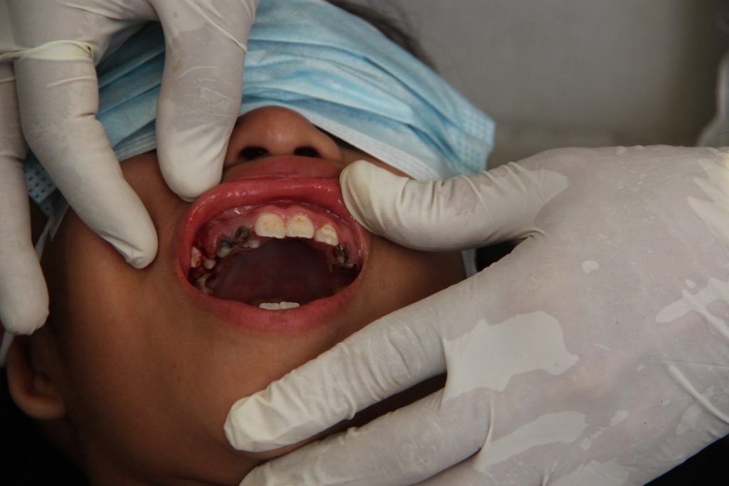 sensitive teeth treatment