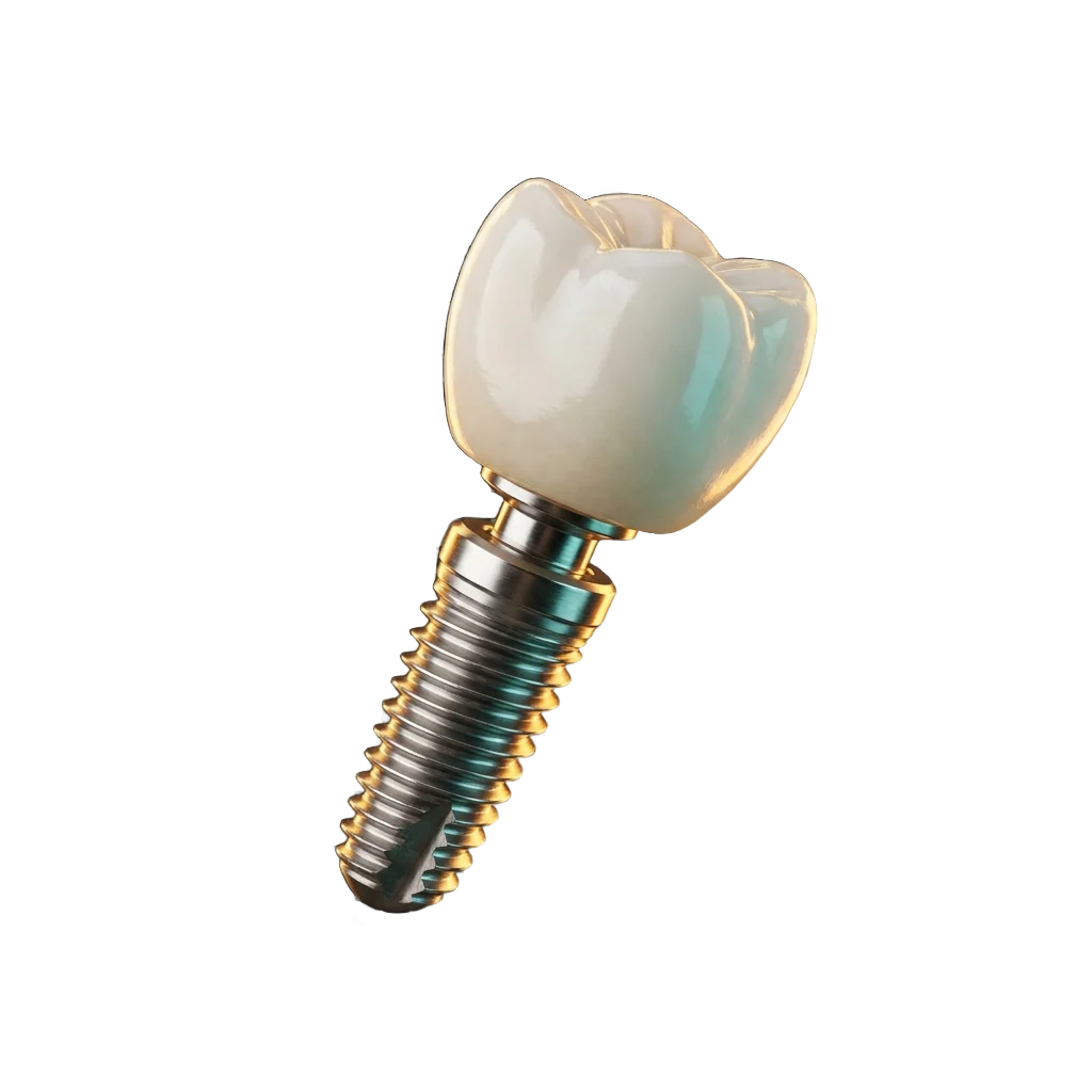 Advanced dental implant — modern restorative dentistry at Snow Tree Dental in Houston